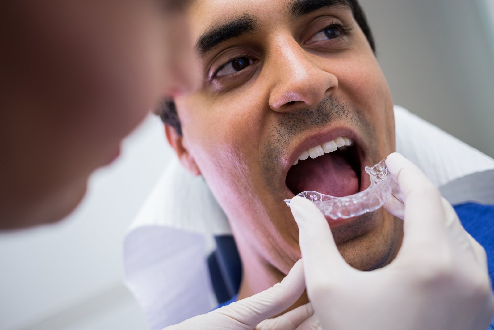 Clear aligners treatment Thoothukudi